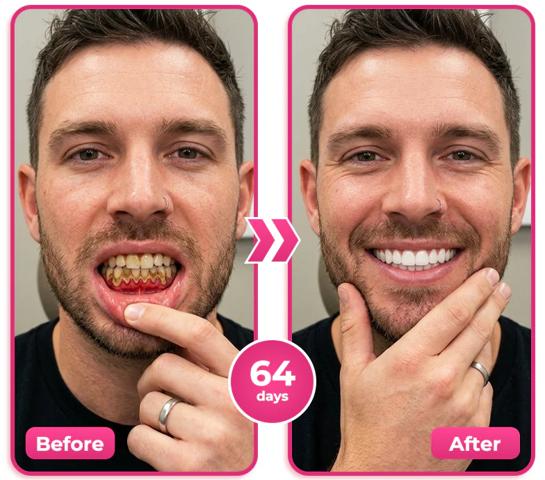 How to use Alcuras Thismile NH-10 toothpaste serum