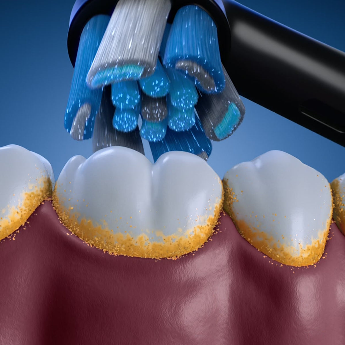 Electric toothbrush bristles positioned tooth by tooth along the gumline to lift visible surface buildup