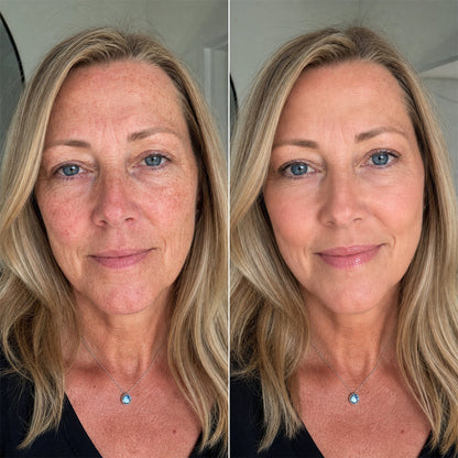 Natural-looking foundation coverage application example